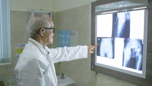 Hình ảnh TTƯT. BS. CKII. Phan Văn Tiếp xem phim X-Quang vùng dị tật tay chân bẩm sinh