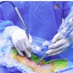 PHẪU THUẬT NỘI SOI CỘT SỐNG – “CHÌA KHÓA” GIÚP NGƯỜI BỆNH HẸP ỐNG SỐNG LẤY LẠI KHẢ NĂNG VẬN ĐỘNG