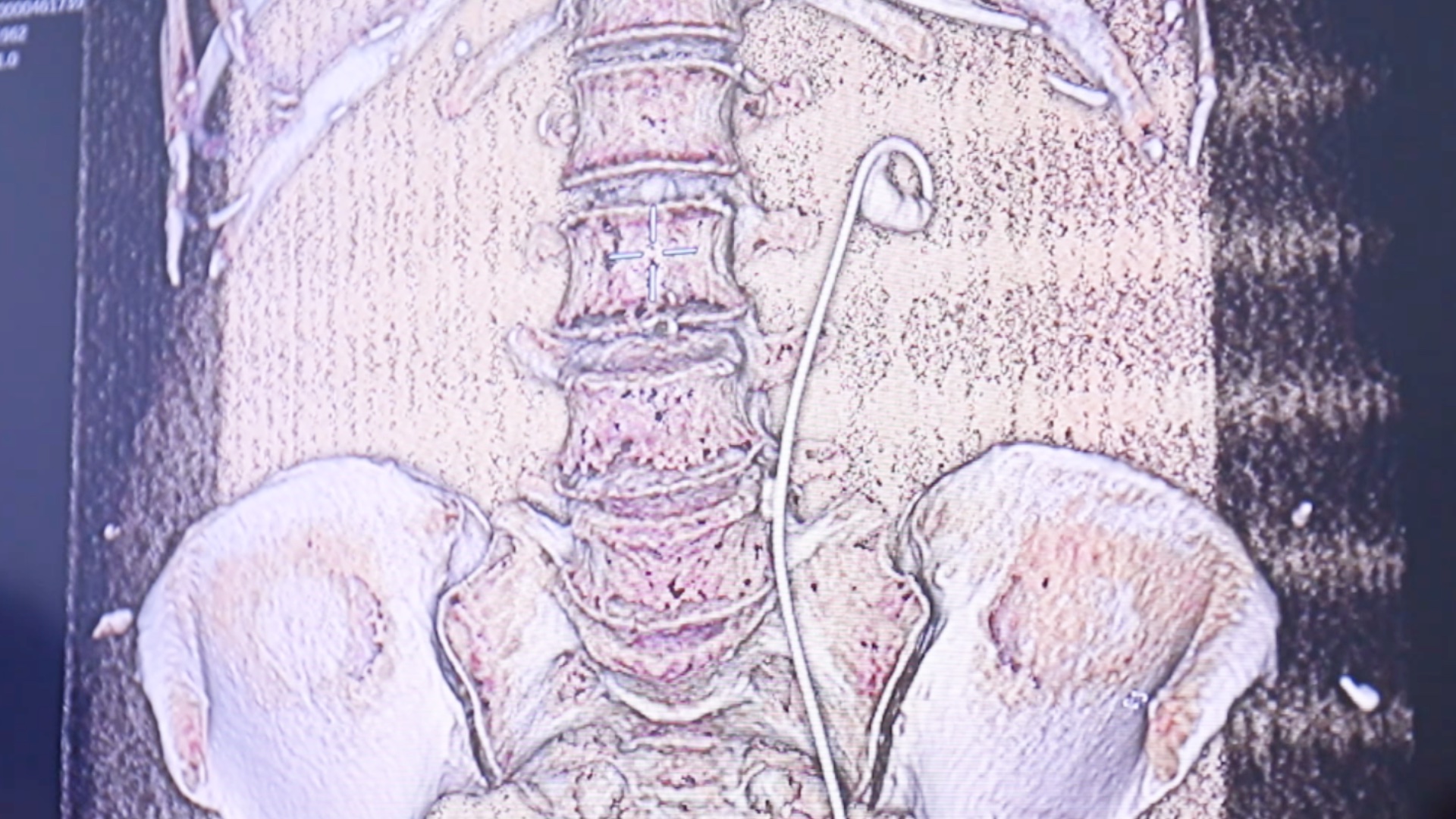 Ảnh tiêu biểu