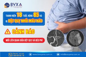 Web - benh-nhan-18-tuoi,-85-kg-dot-quy