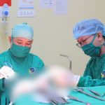 MỘT THÁNG SAU CHẤN THƯƠNG ĐẦU, ÔNG CỤ 75 TUỔI ĐƯỢC PHÁT HIỆN KHỐI MÁU TỤ GÂY CHÈN ÉP NÃO.