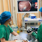 TRONG LÚC CHƠI ĐÙA, BÉ TRAI 5 TUỔI NUỐT NAM CHÂM – CẢNH BÁO NGUY CƠ HÓC, NUỐT DỊ VẬT Ở TRẺ NHỎ