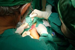 Hình ảnh TTƯT. BS. CKII. Phan Văn Tiếp cùng ekip phẫu thuật