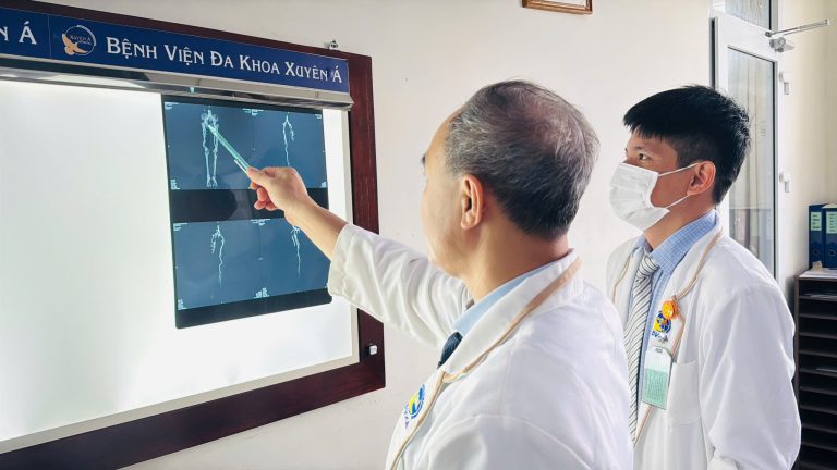 ĐIỀU TRỊ TẮC ĐỘNG MẠCH ĐÙI CẤP TÍNH Ở BỆNH NHÂN 95 TUỔI BẰNG PHẪU THUẬT LẤY HUYẾT KHỐI