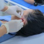 TỪ LỖ RÒ LUÂN NHĨ TỚI ÁP XE VÙNG TAI – DỊ TẬT LÀNH TÍNH NHƯNG KHÔNG NÊN CHỦ QUAN