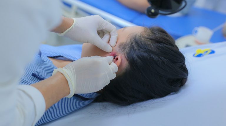 TỪ LỖ RÒ LUÂN NHĨ TỚI ÁP XE VÙNG TAI – DỊ TẬT LÀNH TÍNH NHƯNG KHÔNG NÊN CHỦ QUAN