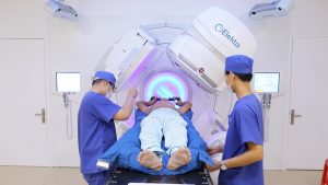 Hình ảnh xạ trị cho bệnh nhân ung thư thực quản