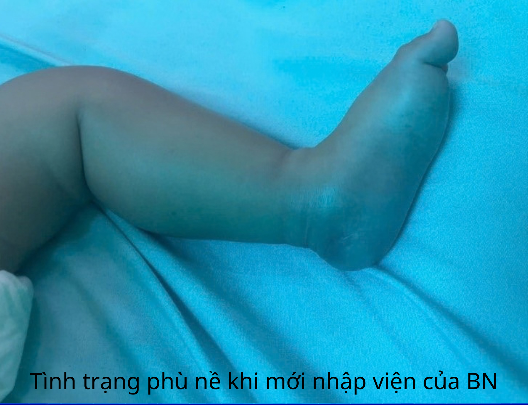 Ảnh tiêu biểu